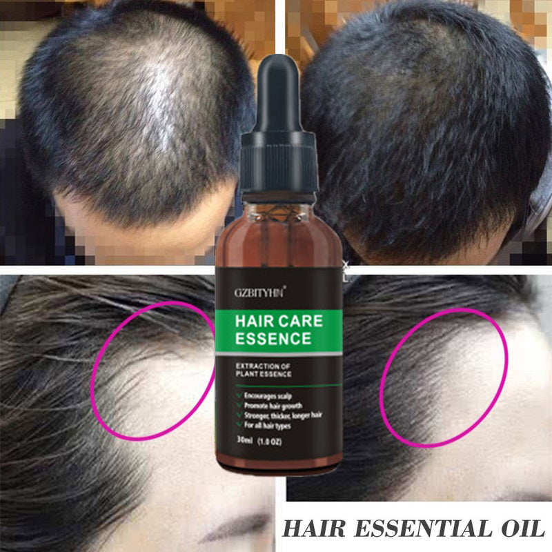 Hair Growth & Scalp Care Serum – Nourish, Strengthen & Prevent Hair Loss (30ml)