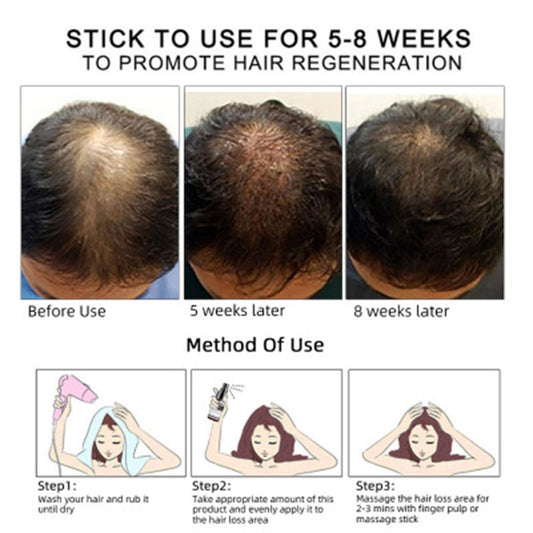 Hair Growth & Scalp Care Serum – Nourish, Strengthen & Prevent Hair Loss (30ml)