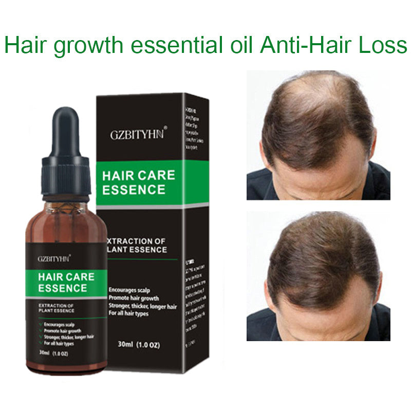 Hair Growth & Scalp Care Serum – Nourish, Strengthen & Prevent Hair Loss (30ml)