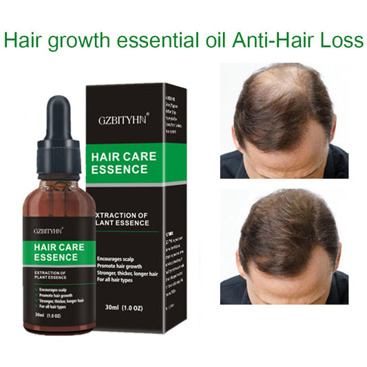 Hair Growth & Scalp Care Serum – Nourish, Strengthen & Prevent Hair Loss (30ml)